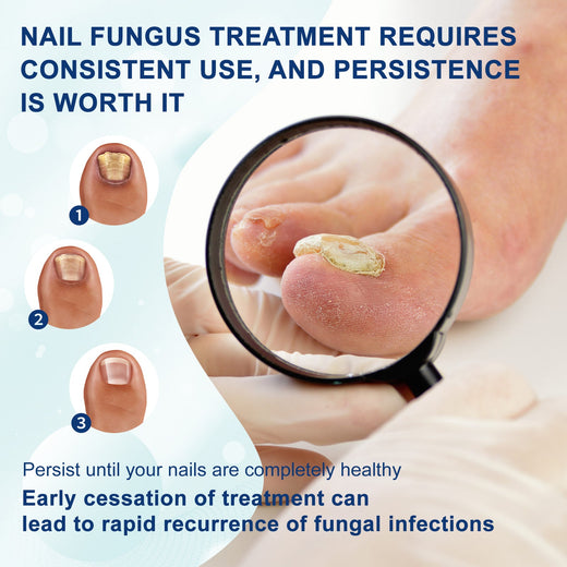 Nail Repair Pen for Fungus - Precision Care, Diabetic-Safe