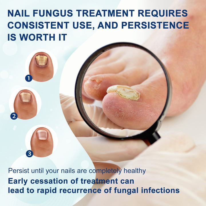 Gentle Precision Nail Care Pen