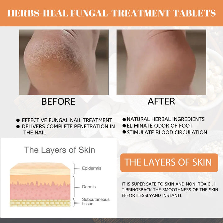 Ginger Foot Soak Tablets for Cracked Heels & Fungal Nails