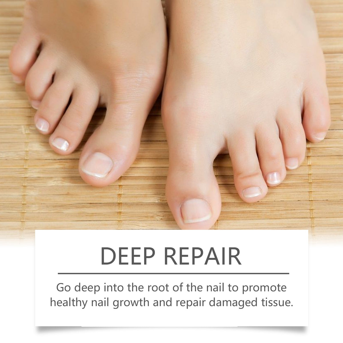 Bee Venom Nail Care Essence for Stronger Cleaner Nails