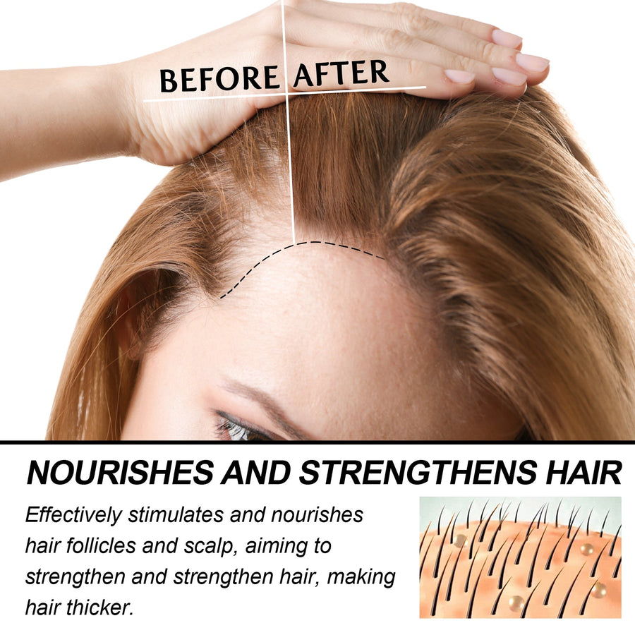 Hair Growth Oil for Thinning Hair and Dry Strands