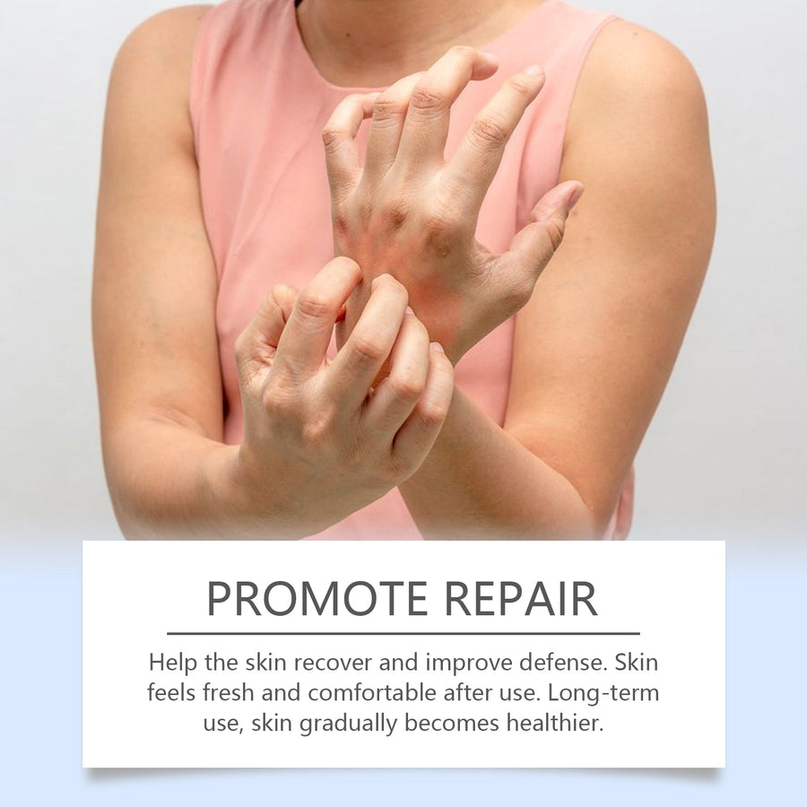 Bee Venom Skin Care Spray for Dry Skin Relief