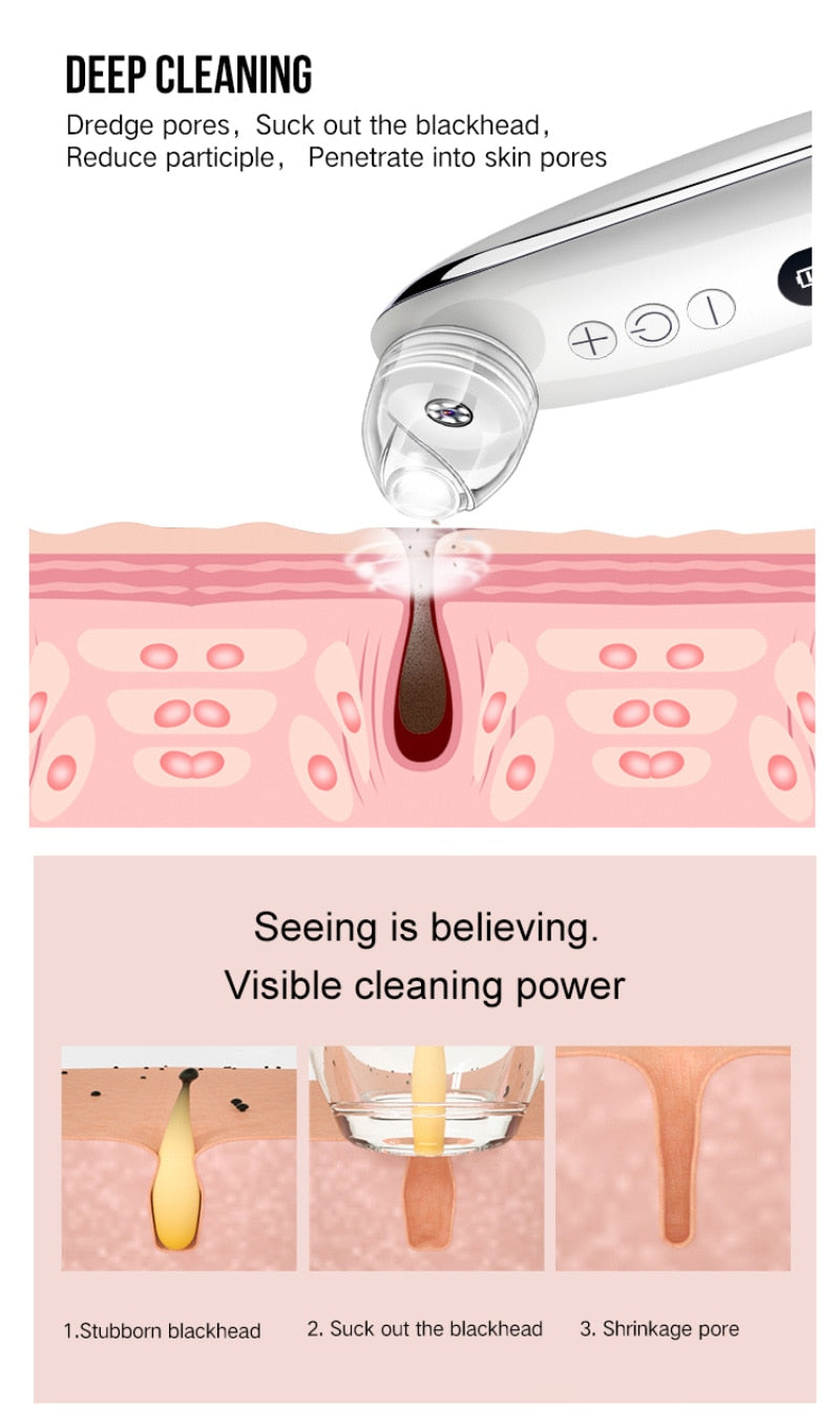 Electric Blackhead Remover with 10x Camera — Visible Pore