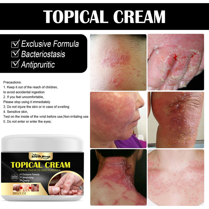 Anti-Itch Cream — Fast Herbal Relief for Bug Bites & Rashes