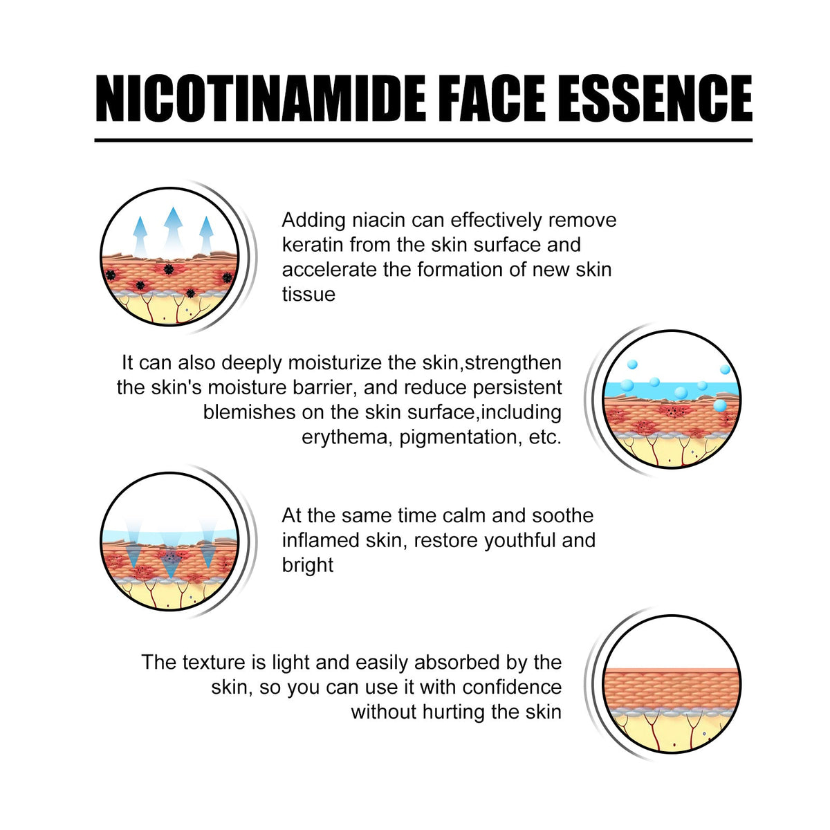 Niacinamide Face Essence for Acne Marks & Pores