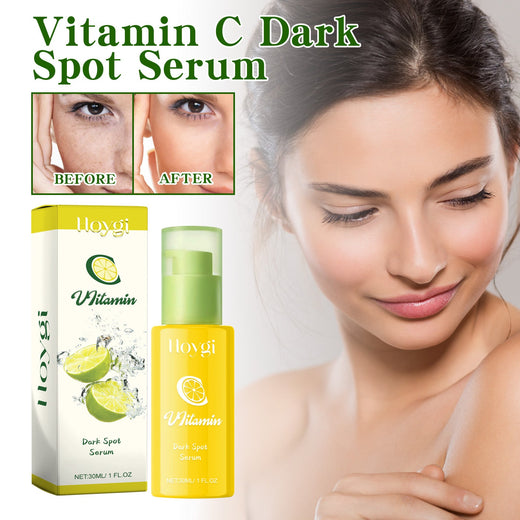Vitamin C Serum for Dark Spots & Fine Lines