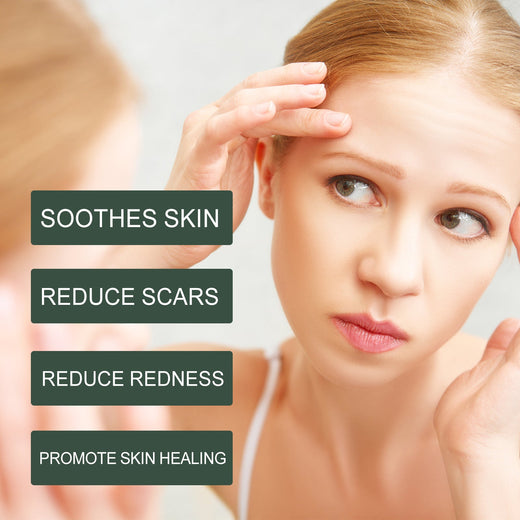Calendula Body Oil for Dry, Red, Scar-Prone Skin Care