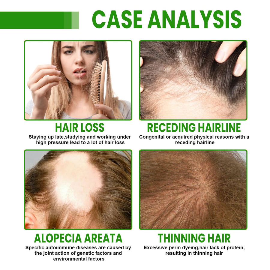 Hair Root Spray for Smoother, Fuller-Looking Hair