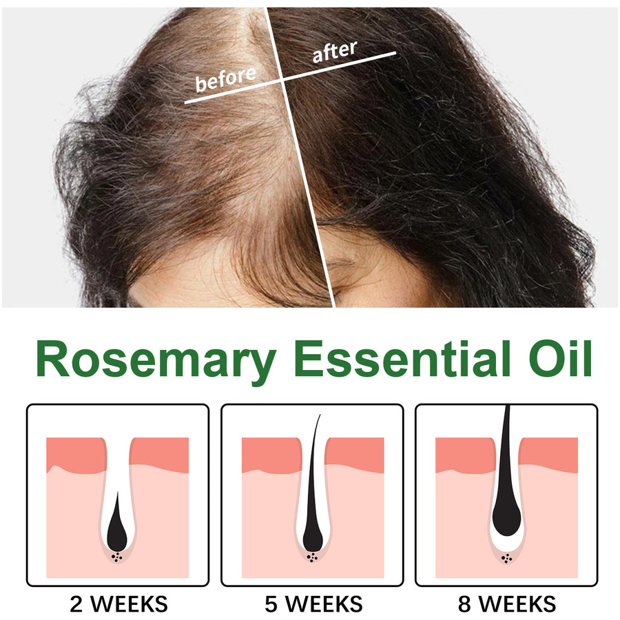 Rosemary Hair Oil for Dry, Damaged Hair and Split Ends