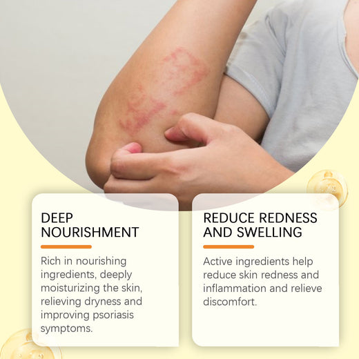 Bee Venom Skin Repair Cream for Psoriasis & Eczema