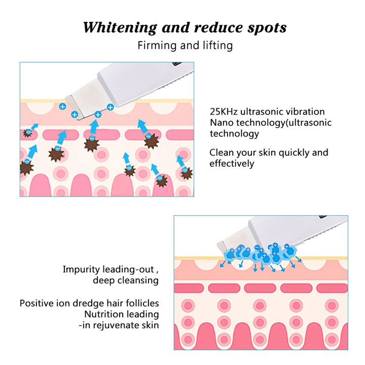 Ultrasonic Skin Scrubber for Deep Pore Cleansing