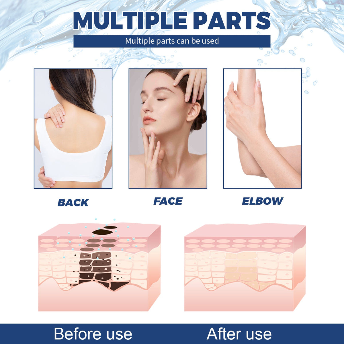 Spot Body Cleanser for Face, Freckles & Uneven Tone