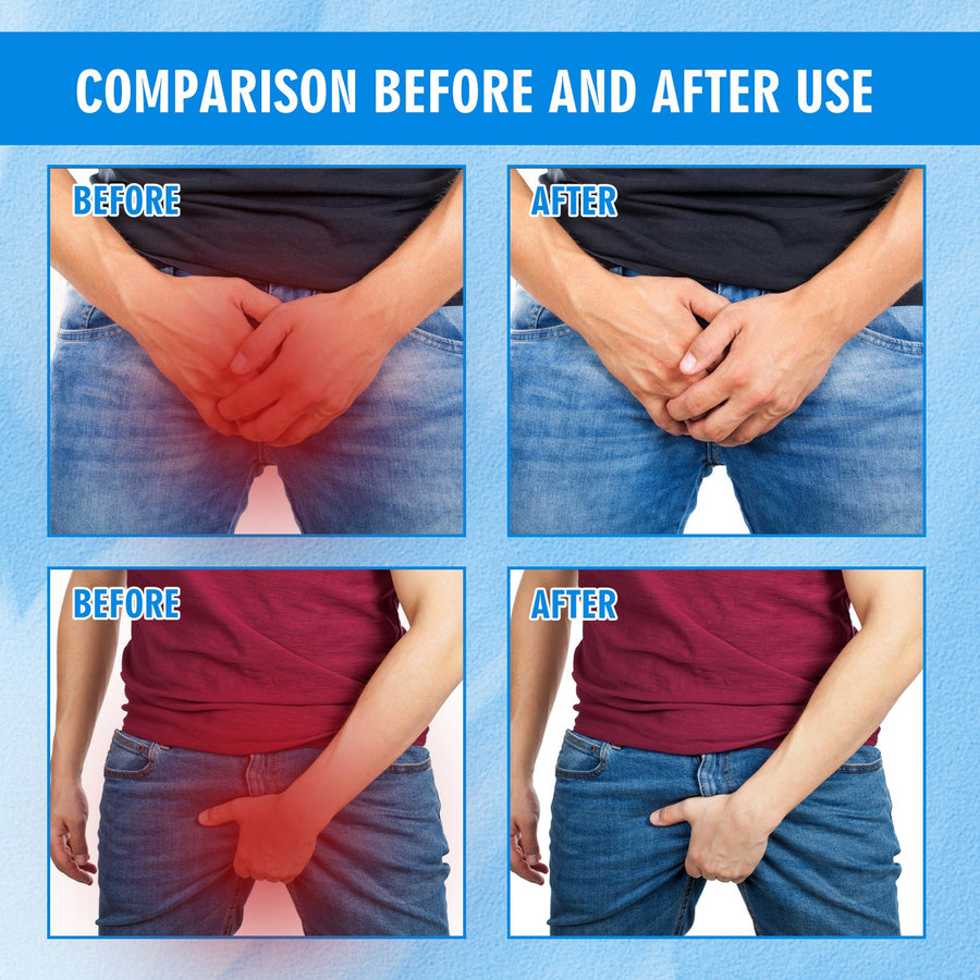 Men's Inner Thigh Itch Relief Cream - Fast Comfort