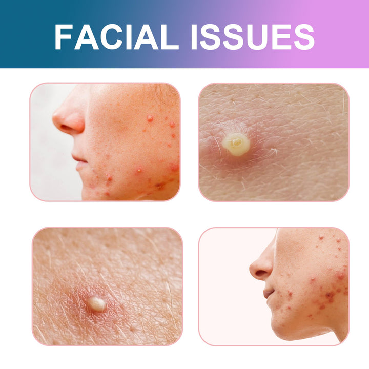 Cute Acne Patches Hydrocolloid 96-Pack Sea Shapes