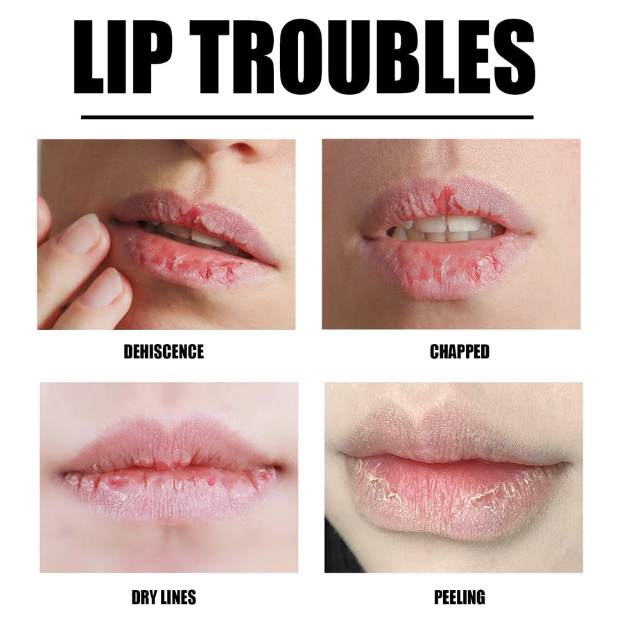 Lip Scrub for Dry Lips — Strawberry Exfoliates & Smooths