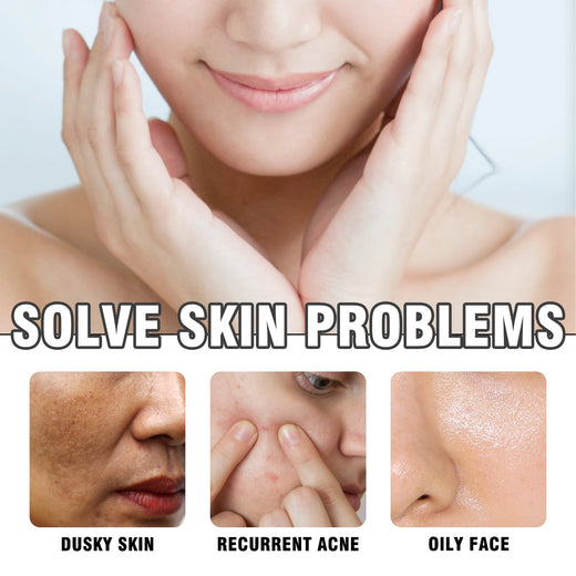 Lavender Acne Soap Bar For Oily Skin Pore Control