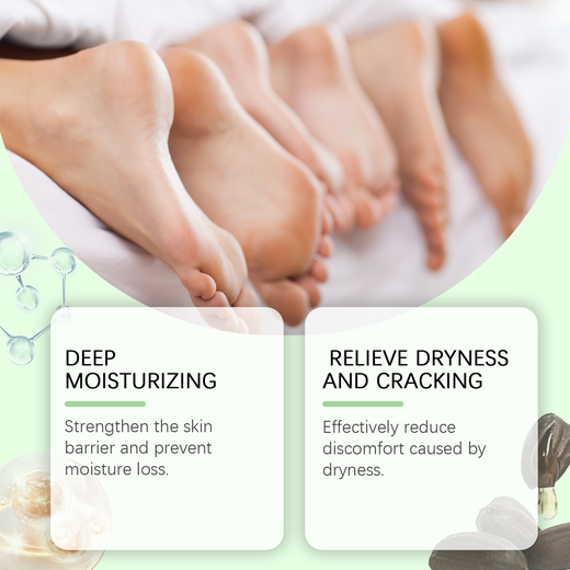 40% Urea Foot Cream for Cracked Heels & Rough Skin