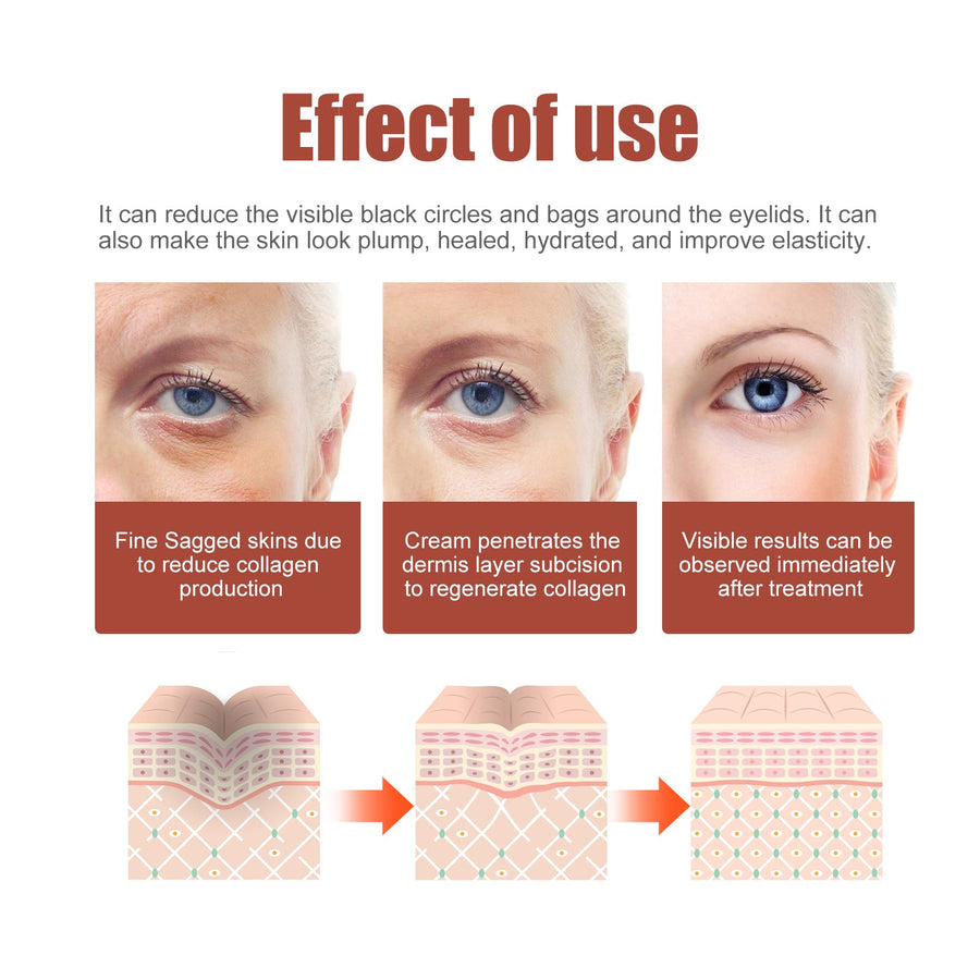 Eye Cream for Fine Lines, Bags & Dark Circle Care
