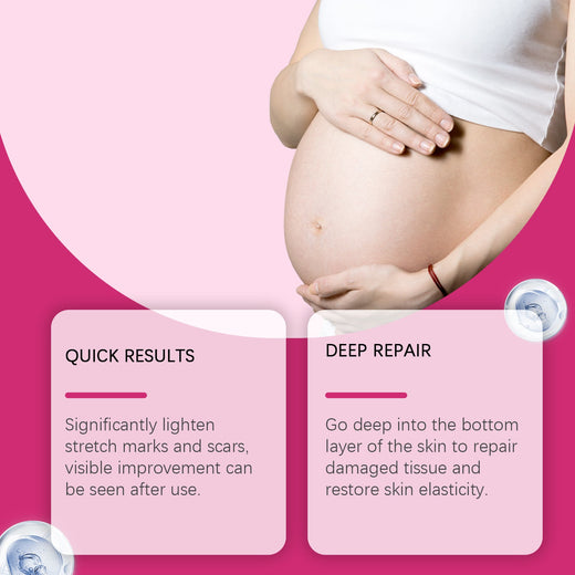 Pregnancy Body Lotion for Deep, Lasting Skin Moisture