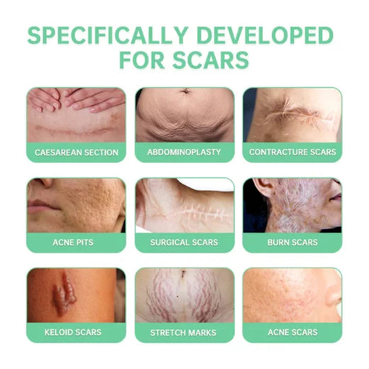 Scar Repair Spray for C-Section, Surgery & Acne Marks