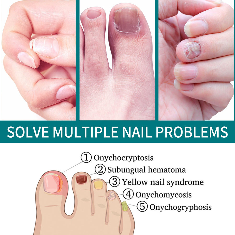 Nail Repair Patches for Smoother, Brighter-Looking Nails