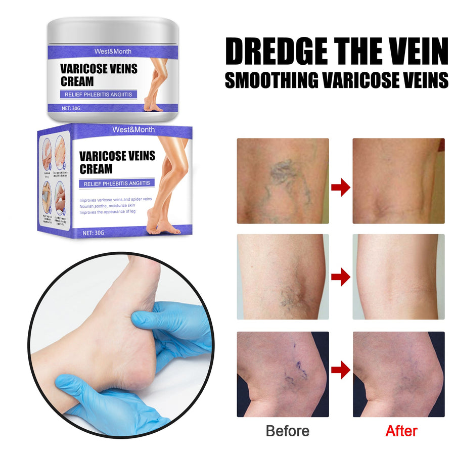 Varicose Veins Cream — Reduces Vein Visibility & Leg Discomfort