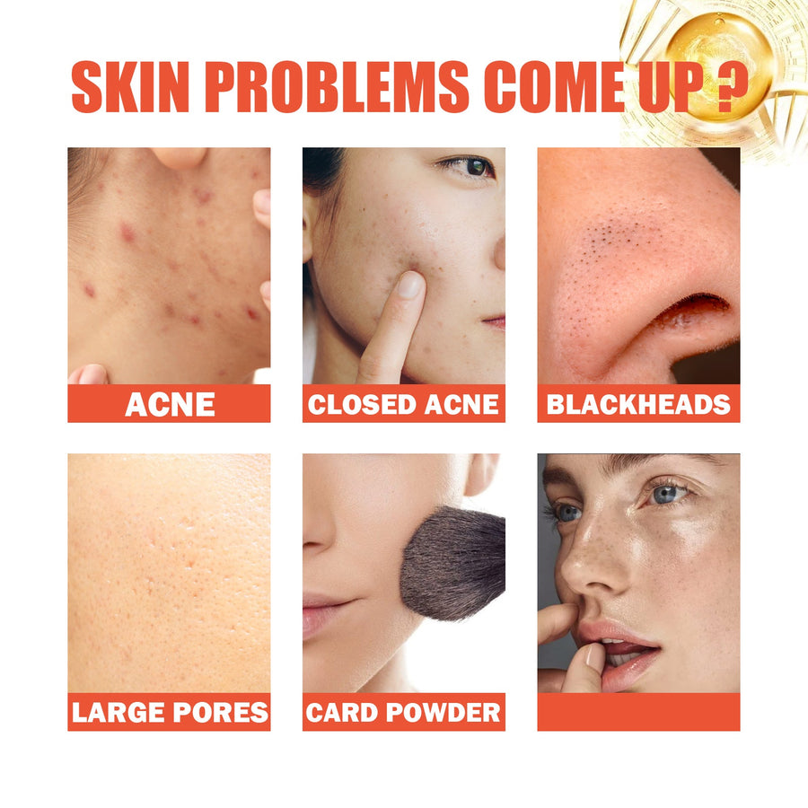 Snail Repair Essence for Acne Marks & Fine Lines
