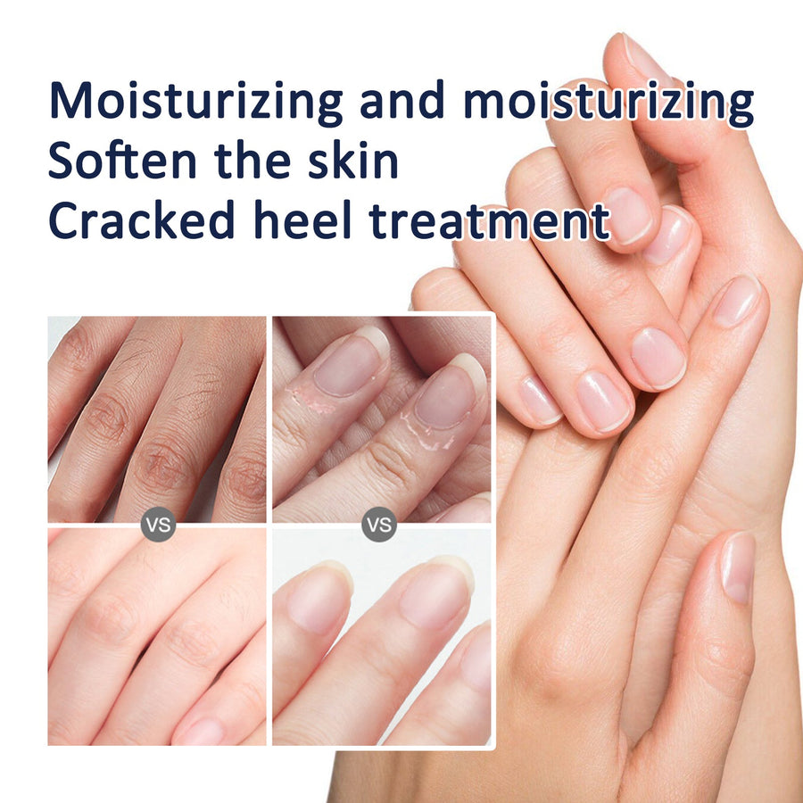 Hand & Foot Repair Cream for Cracked, Rough Skin 30g
