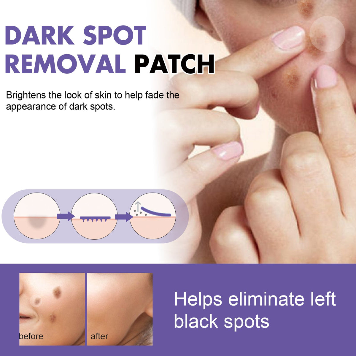 Dark Spot Patches for Melasma & Age Spots, 144-Pack