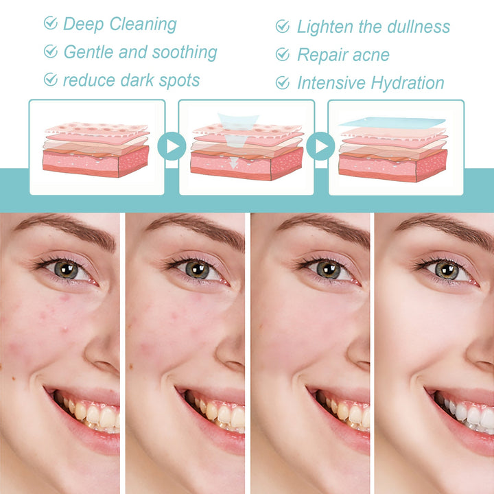 Silk Protein Repair Soap — Clear Acne and Dark Spots