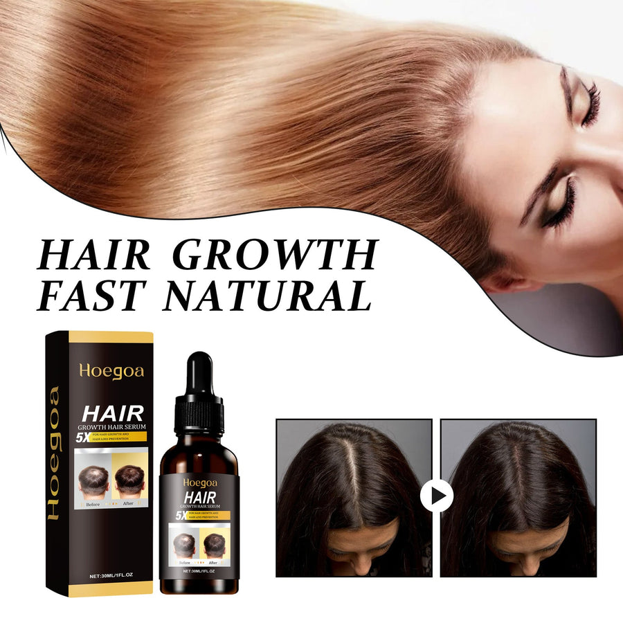 Ginger Hair Growth Serum for Fuller-Looking, Thicker Hair