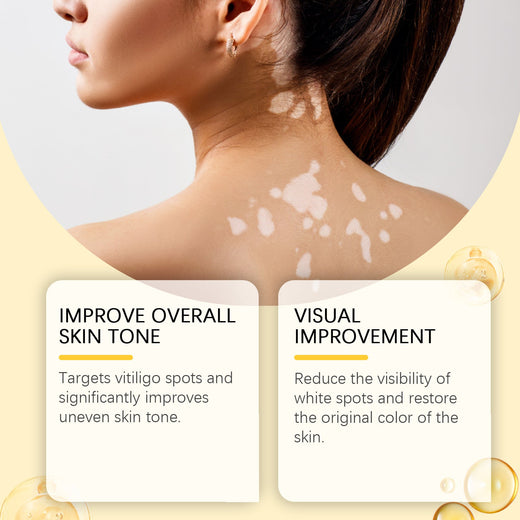 Bee Venom Cream for Visible Skin Tone Discoloration Care