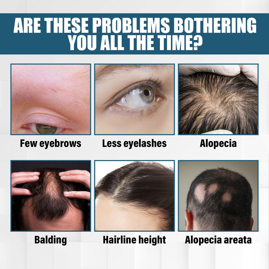 Hair Essence Spray — Visible Hair Density Restoration in 8
