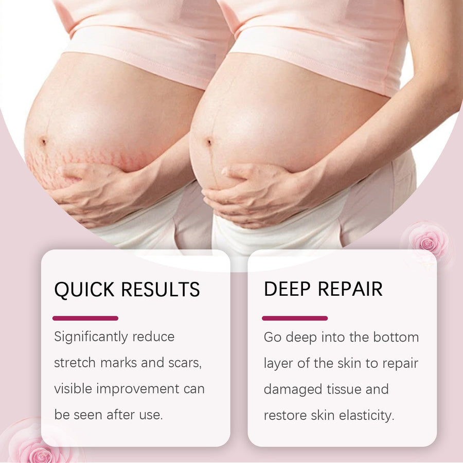 Pregnancy Stretch Mark Oil — Visibly Reduce Stretch Marks