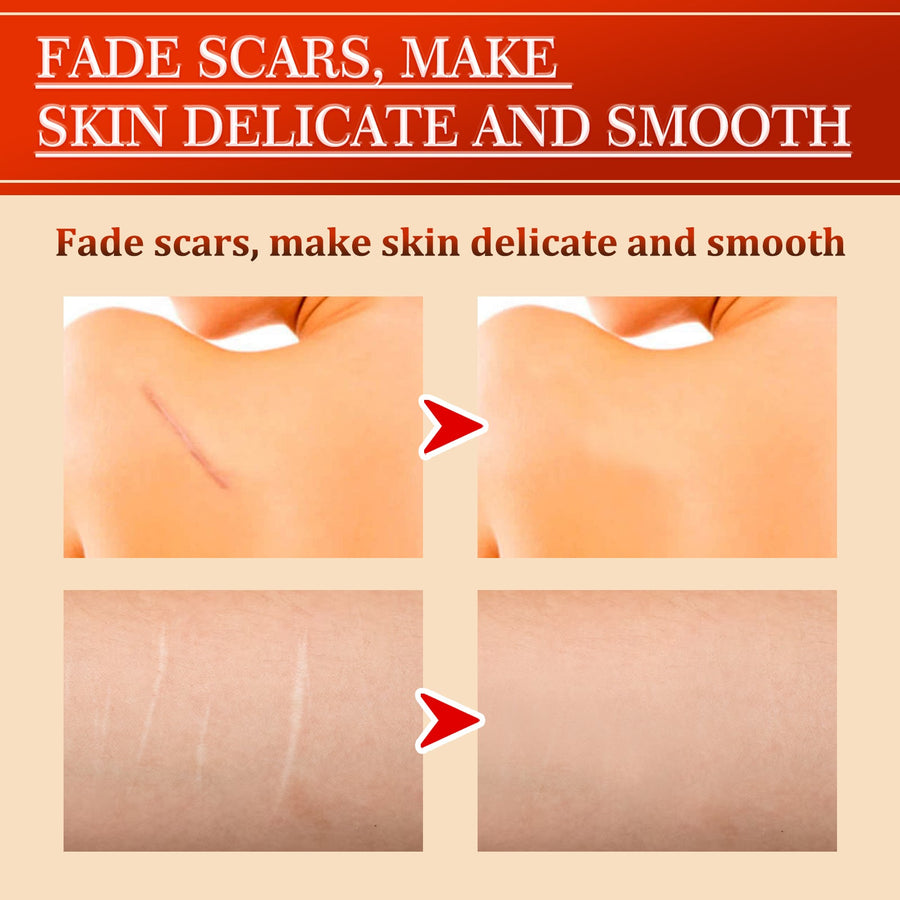 Centella Asiatica Scar Repair Cream — Fade Scars & Smooth Skin