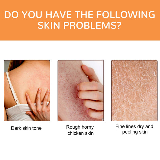 Vitamin C Body Oil for Dark Spots & Bumpy Skin