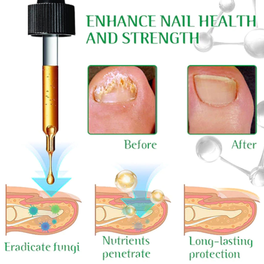 Rosemary Mint Oil — Nail Repair & Hair Strengthening Serum