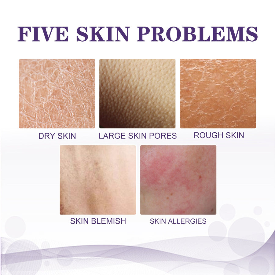 KP Bump Remover Cream for Smoother, Softer Skin