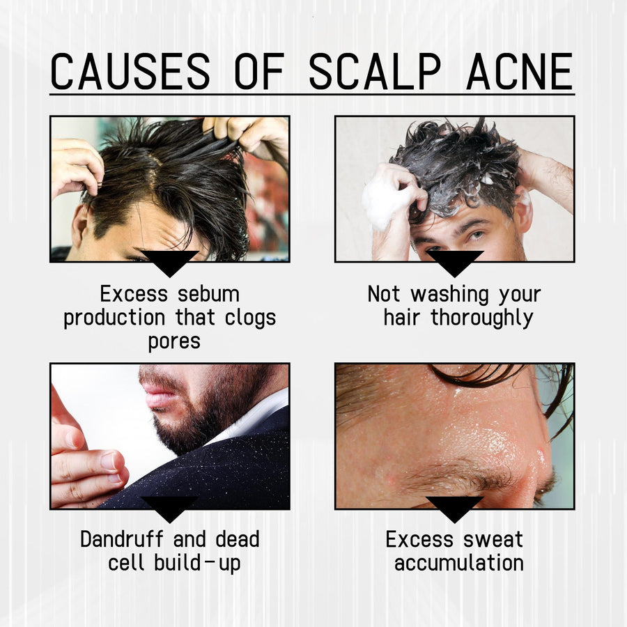 Anti-Shedding Hair Spray for Targeted Hairline Care