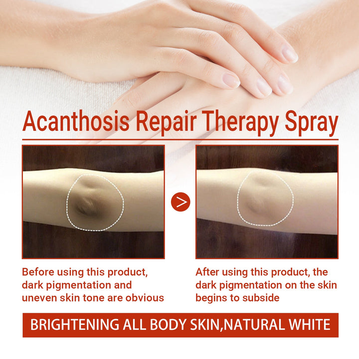 Underarm Dark Spot Spray for Brightening Rough Skin