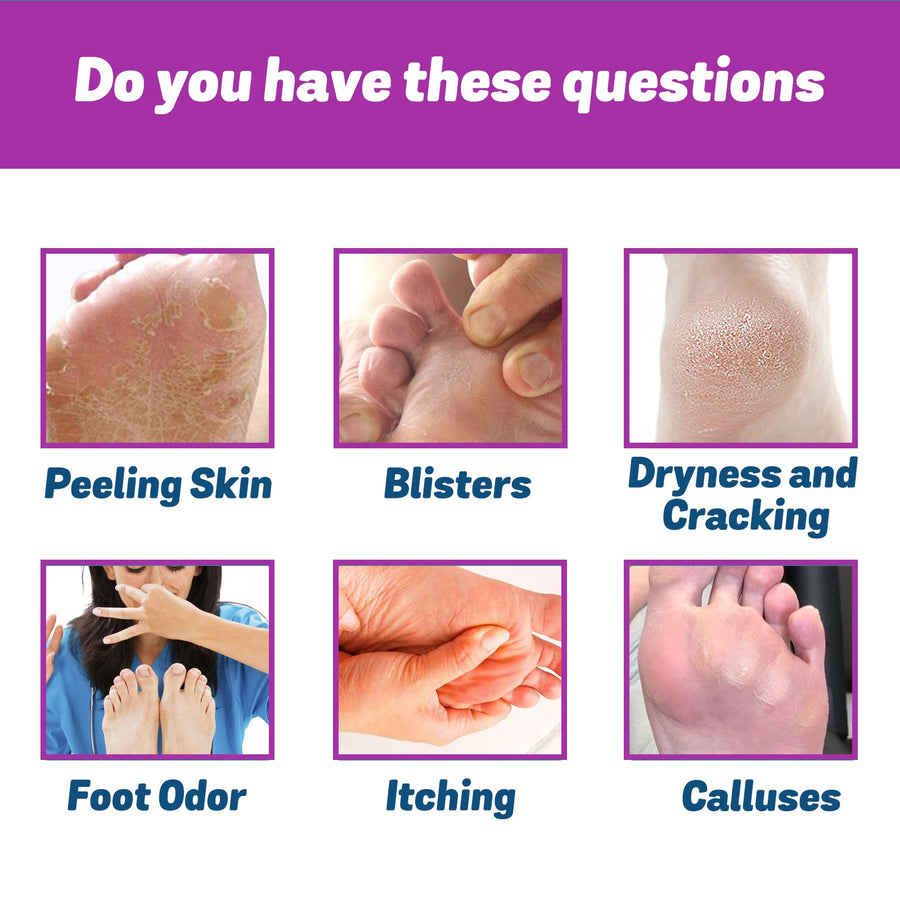 Foot Odor Spray That Kills Bacteria In Seconds