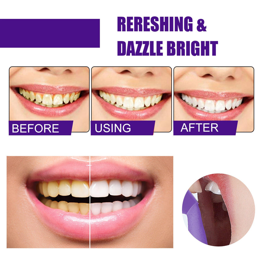 Teeth Whitening Mousse — Instant Brightening with Colour