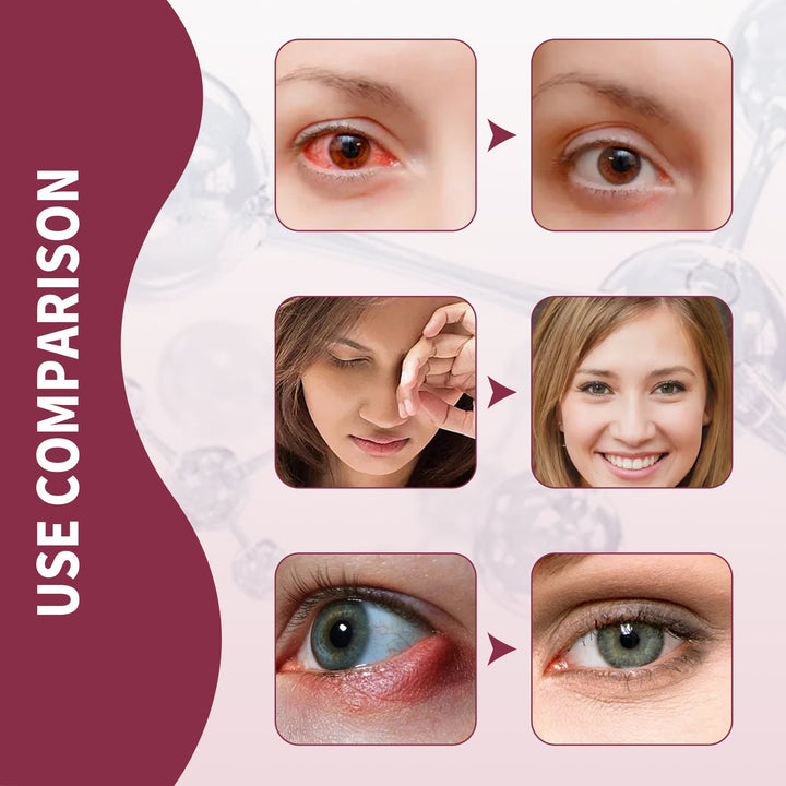 Eye Relief Serum for Redness, Swelling & Dry Eye Care