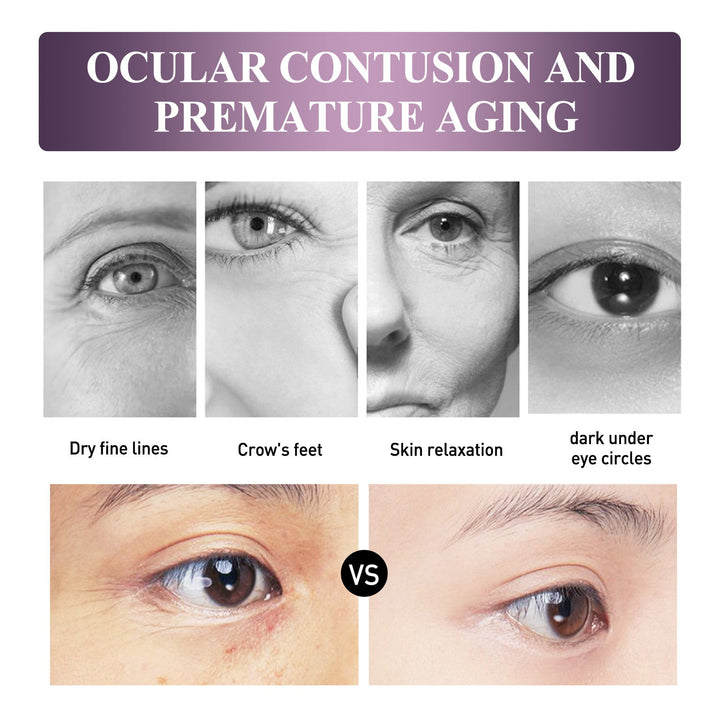 Electric Eye Cream for Dark Circles & Fine Lines