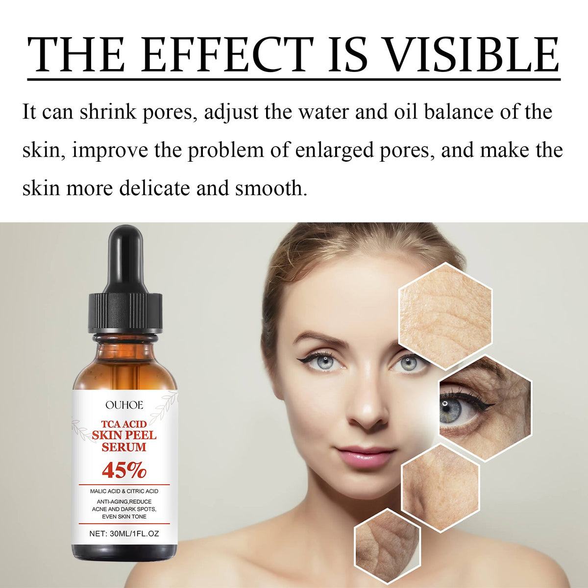 TCA 45% Acid Peel Serum for Pores & Dark Spots