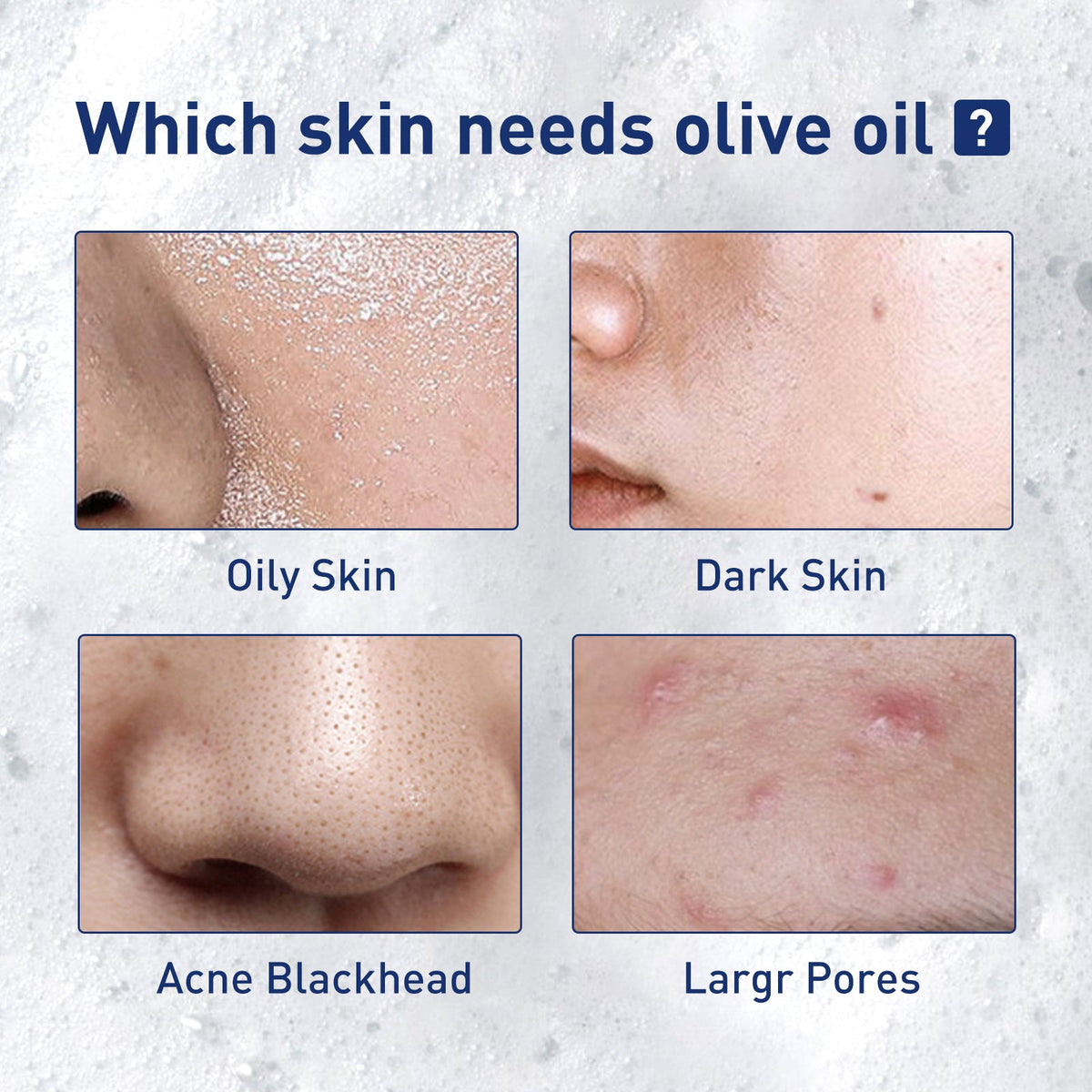 Exfoliating Mousse Cleanser for Pores & Blackheads