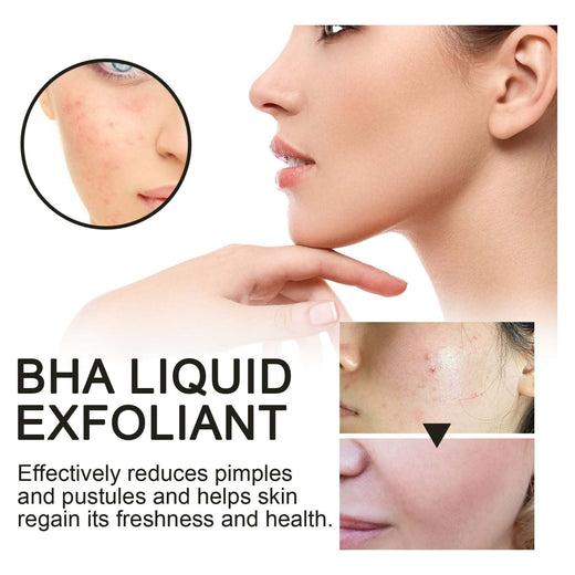 2% BHA Liquid Exfoliant for Clogged Pores & Acne