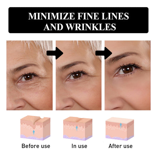 Eye Firming Cream for Fine Lines & Dry Under-Eye Skin