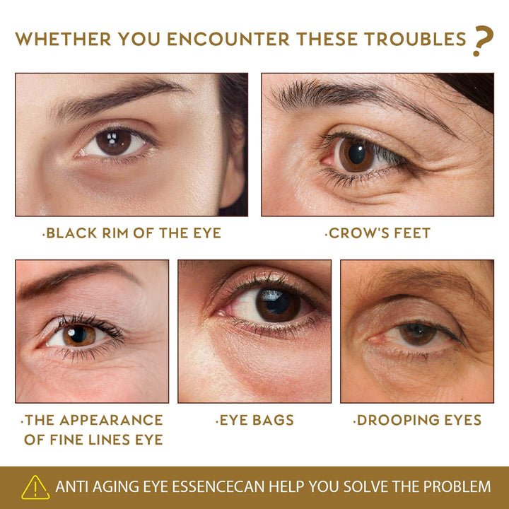 Anti-Aging Eye Serum for Dark Circles, Puffiness & Lines