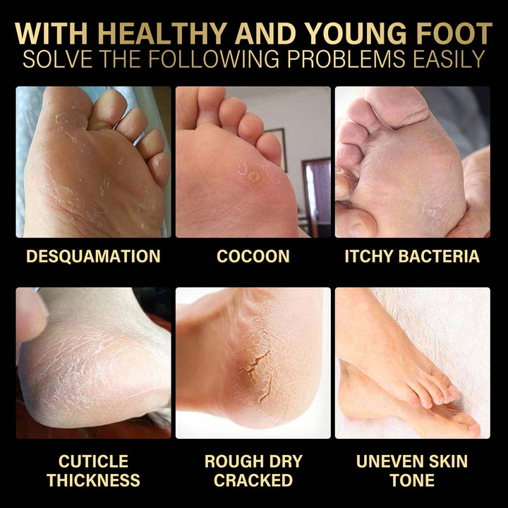 Lavender Foot Peel Mask for Soft, Crack-Free Heels